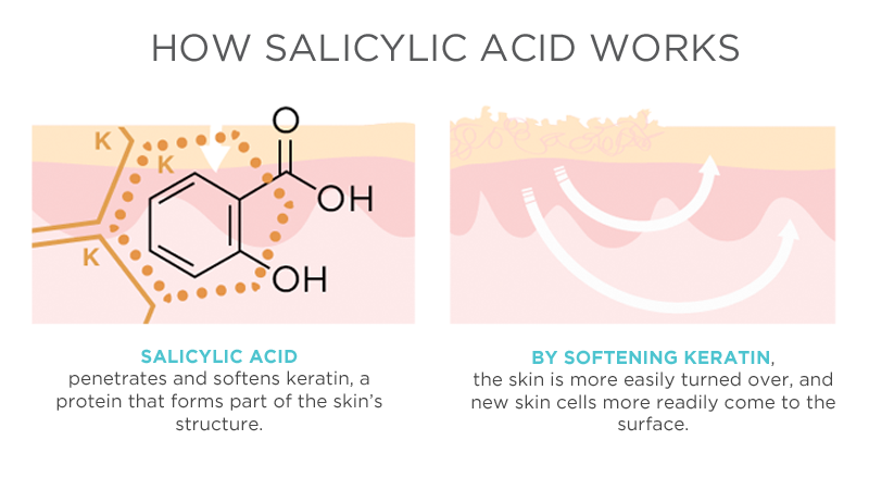 salicylic-acid-va-nhung-dieu-can-biet-f